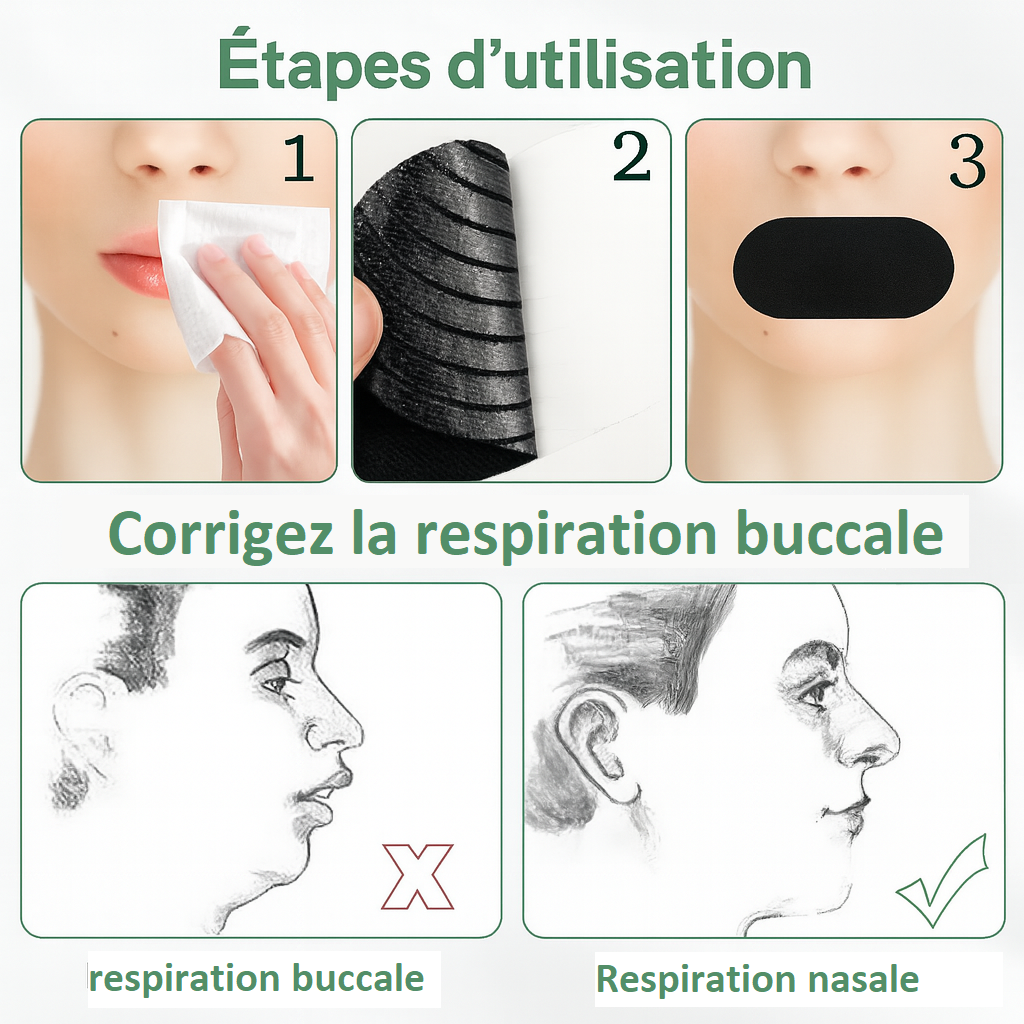 Ruban buccal